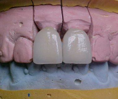 caso clinico dental hesire (11)