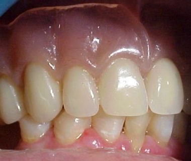 caso clinico dental hesire (3)