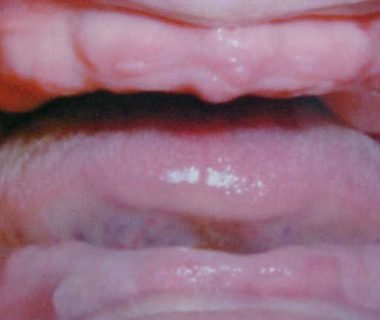 caso clinico dental hesire (4)