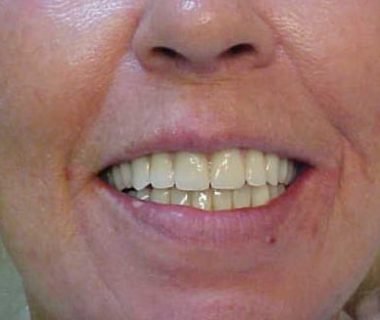 caso clinico dental hesire (6)