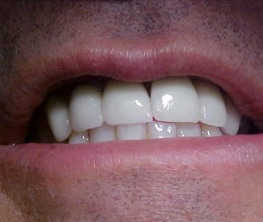 caso clinico dental hesire (7)